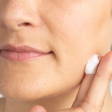Load image into Gallery viewer, 5% Acne Med 1.5 oz